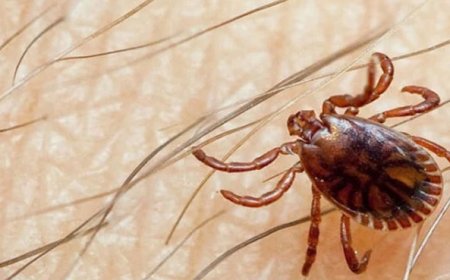 Another Congo virus patient dies in Pakistan